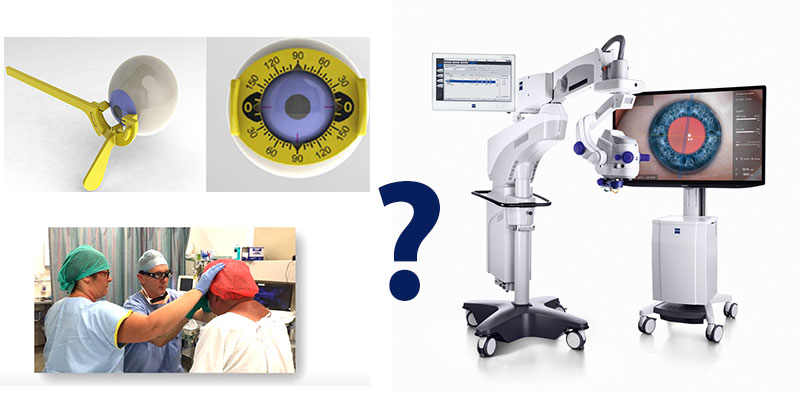 Manual vs Digital Eye Marking for Cataract Surgery
